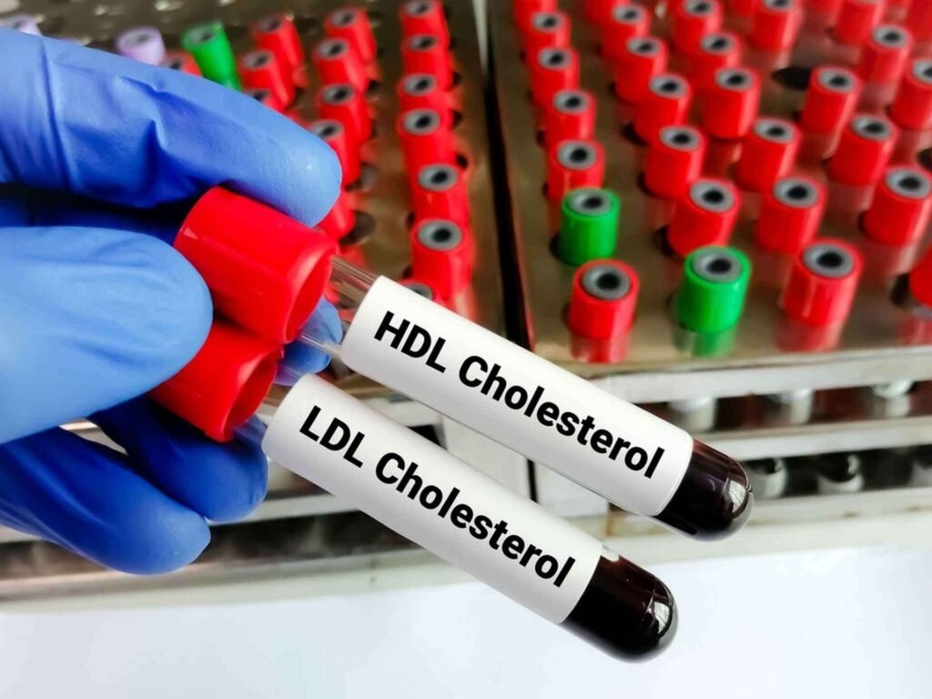 Cholesterol is divided into two types: LDL, or “bad cholesterol,” which must be reduced to stay healthy, and HDL, or “good cholesterol.” © Saiful52, Shutterstock
